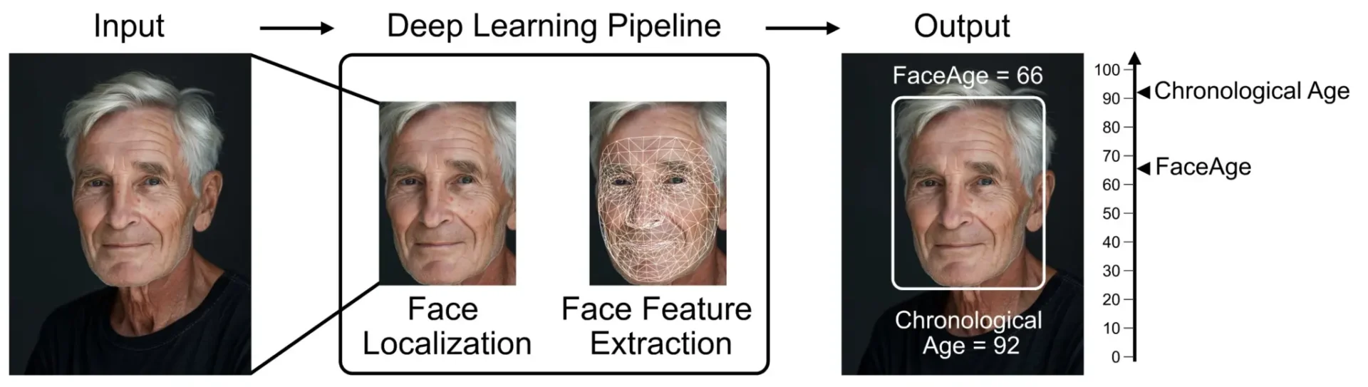 Faceage yapay zekasının yüz fotoğrafı üzerinden yer tespiti ve özellik çıkarımı yaparak kronolojik yaş ile biyolojik yaş farkını hesapladığı derin öğrenme sürecini gösteren teknik diyagram.